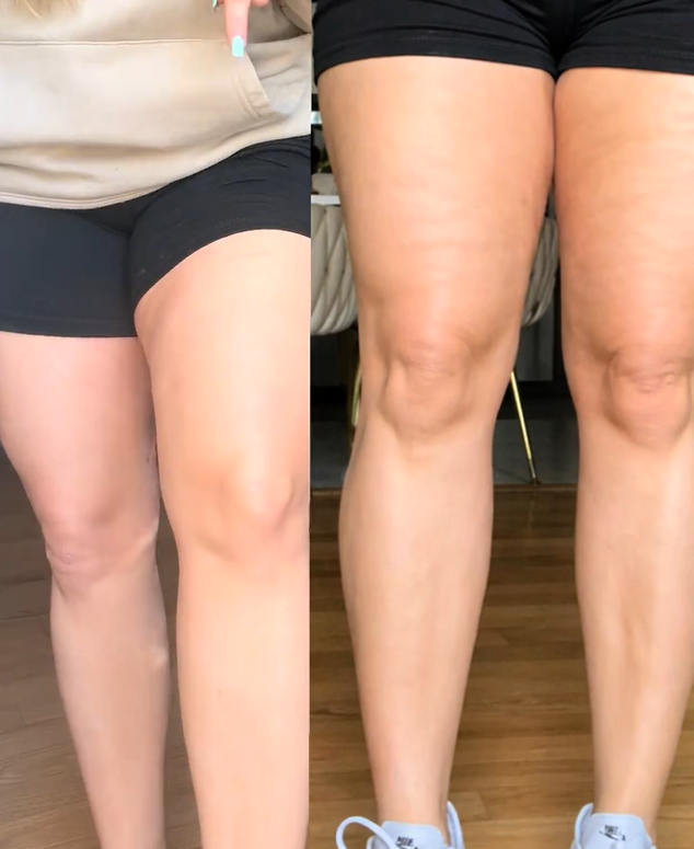 <p><strong>Why Women Are Obsessed</strong></p>